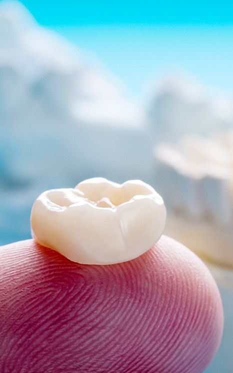 Dental crown resting on a fingertip with a model jaw blurry in the background
