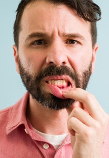 man showing inflamed gums 