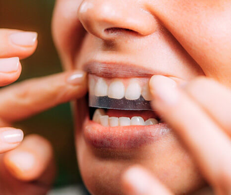 woman using teeth whitening strips